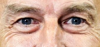 Un primo piano strettissimo di Jürgen Klinsmann!